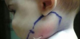 A observat un fela de fir în obrazul fiicei și a tras ușor de el.