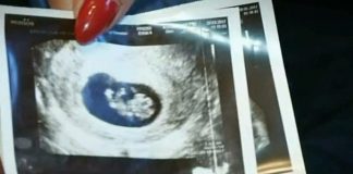 copil nascut mort la Negresti Oas